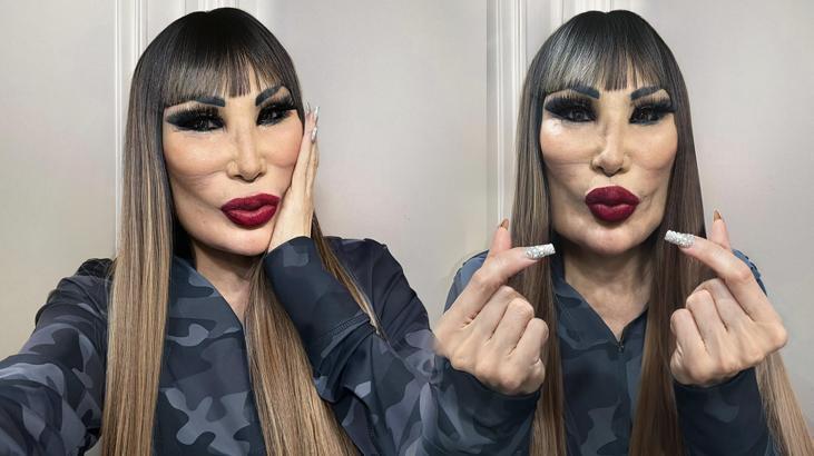 Lyn May değişimiyle bambaşka biri oldu! Yüzüne yaptırdığı işlemler şoke etti