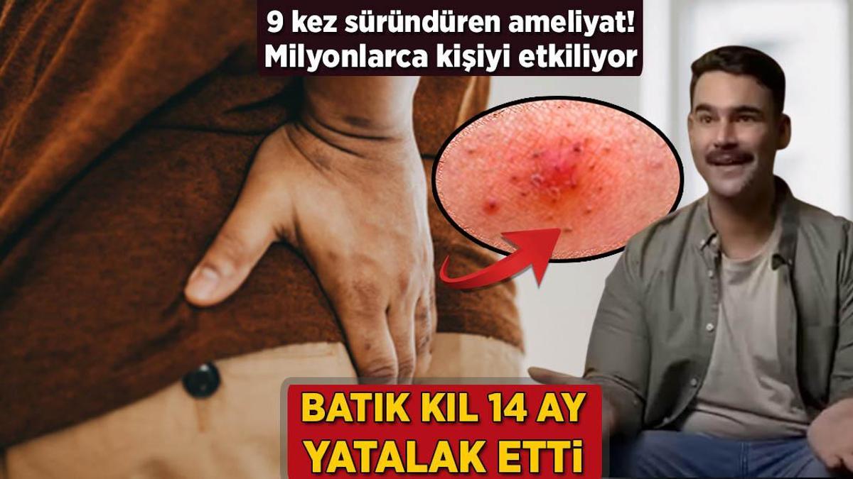 İçeri batan kıl 14 ay yatalak etti! 9 kez süründüren ameliyat, milyonları etkiliyor